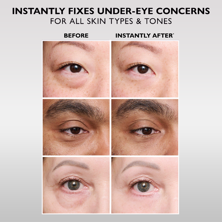 🔥The Express Anti-Wrinkle – Instant Lifting Effect