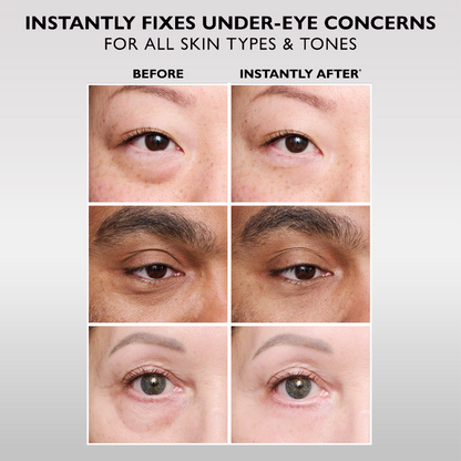 🔥The Express Anti-Wrinkle – Instant Lifting Effect