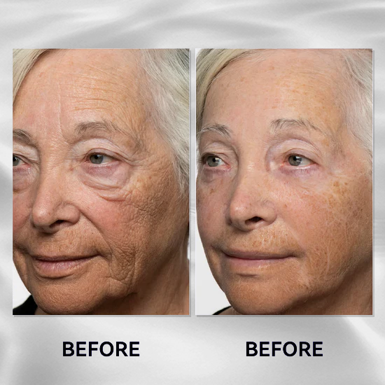 🔥The Express Anti-Wrinkle – Instant Lifting Effect