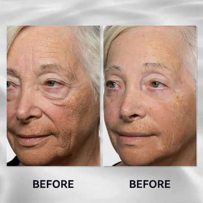 🔥The Express Anti-Wrinkle – Instant Lifting Effect