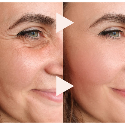 🔥The Express Anti-Wrinkle – Instant Lifting Effect